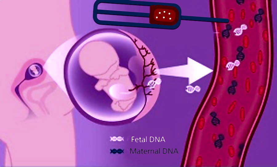 Dna fetal en sangre materna hot sale