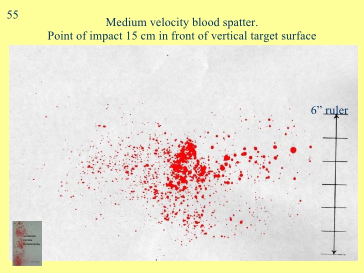 Blood Spatter Patterns