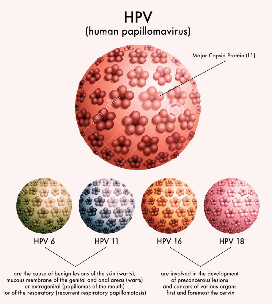 Cervical Cancer