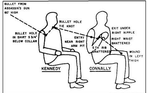 The JFK Assassination