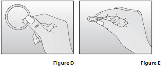 Vaginal Ring
